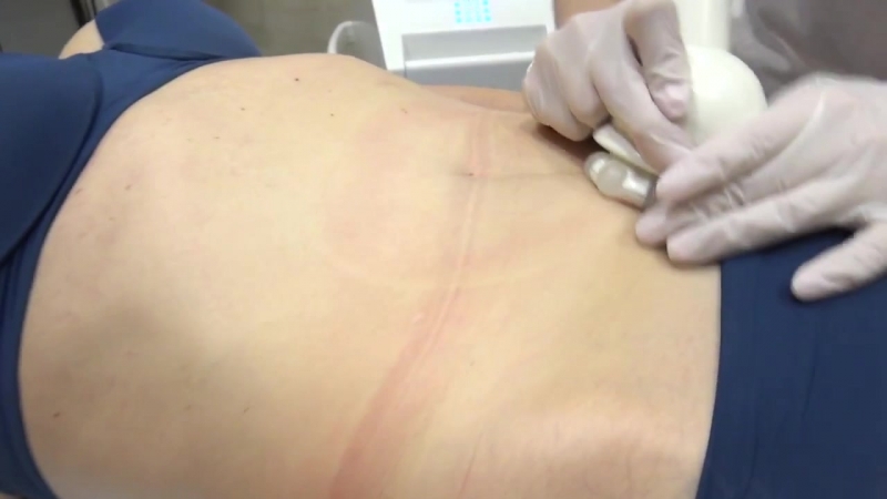 Пример процедуры! успей записаться!