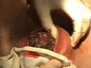 Рождение ребенка