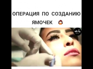 Операция по созданию ямочек