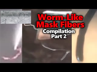 Mask worms parasites morgellons moving black mystery thread compilation part 2