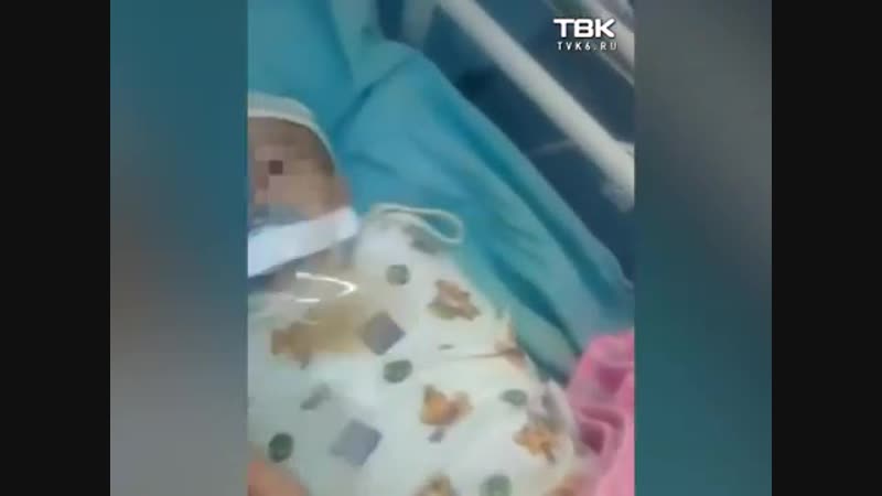 В перинатальном центре младенцу пластырем заклеили рот с пустышкой