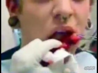 Tongue splitting