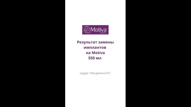 Результат замены имплантов