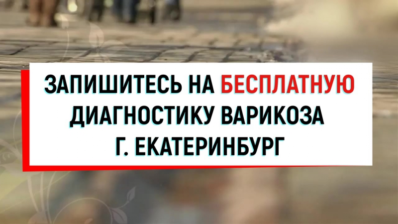 Екатеринбург диагностика варикоза