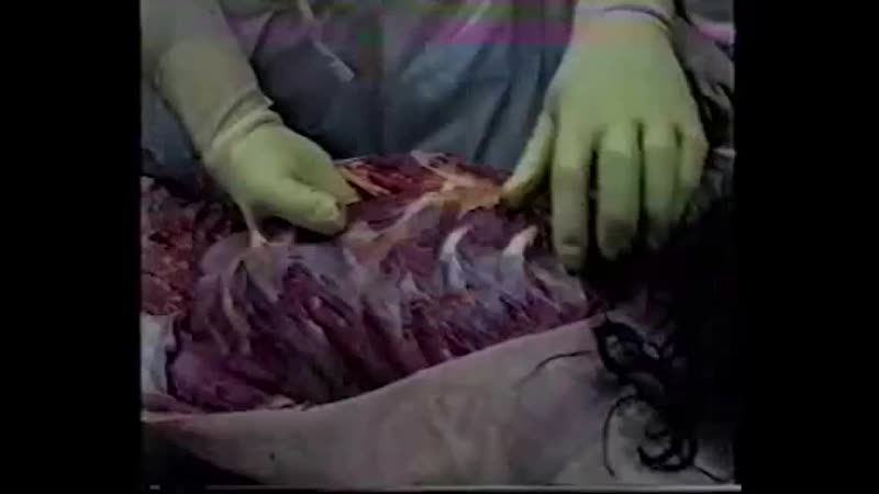 Вскрытие брюнетки