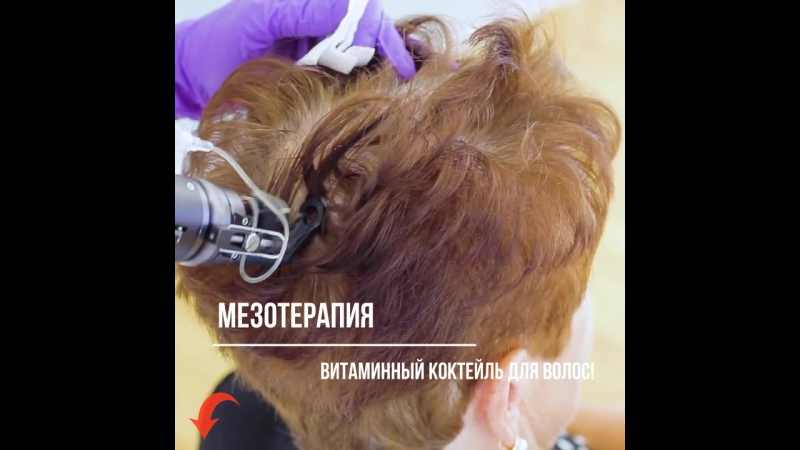 Мезотерапия