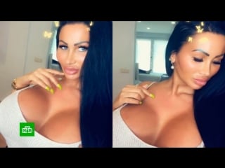 Немецкая барби закачала в грудь 10 литров силикона