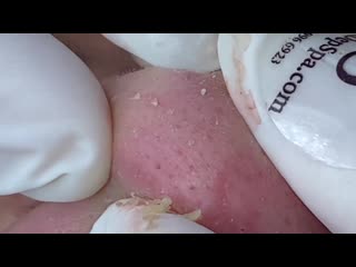 Стандартная чистка лица