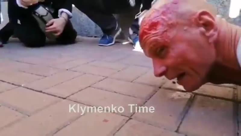 Оторвали чуб