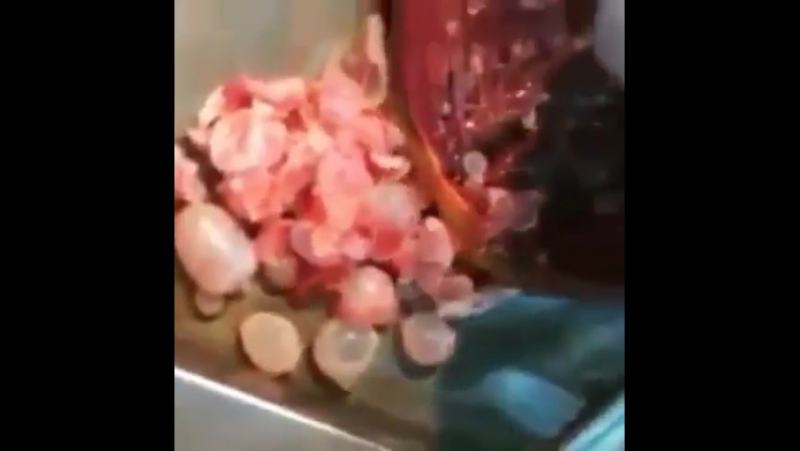 Чрезвычайно редкий случай инфекции echinococcus granulosus