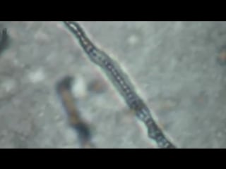 Kitasatospora or an interesting live soil actinobacteria under microscope