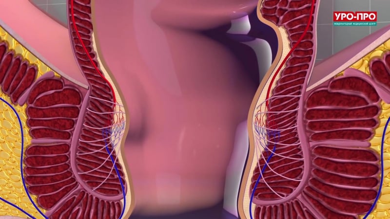 Секс при геморрое (анальный) - можно ли заниматься до и после операции