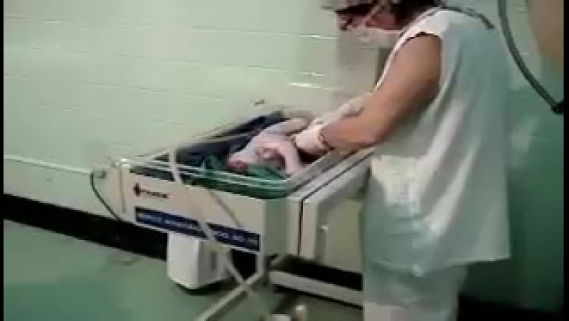 Кесарево сечение (без комментариев, музыкальное сопровождение)