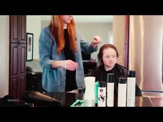 Синдром дауна