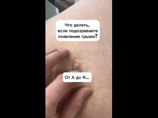 Видео от врач хирург, онколог киров филиппов николай альб