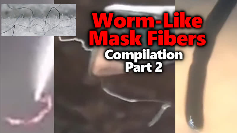 Mask worms parasites morgellons moving black mystery thread compilation part 2
