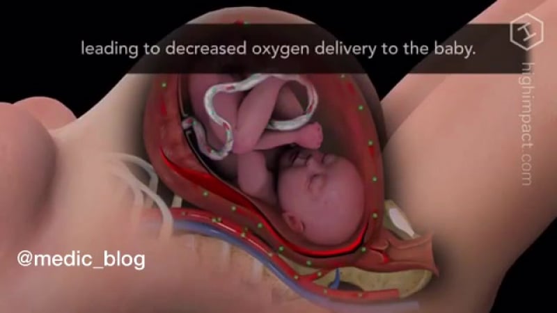 На видео показано кровообращений между матерью и ребёнком