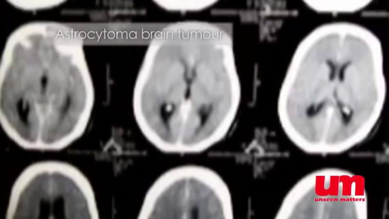 Влияние мобильных телефонов на человека «резонанс»