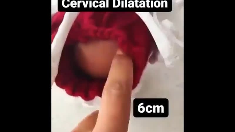 Как проверяют раскрытие шейки матки?