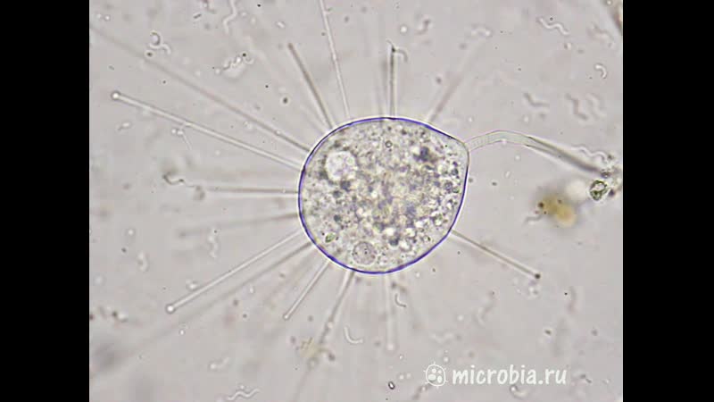 Сосущая инфузория, 1000х