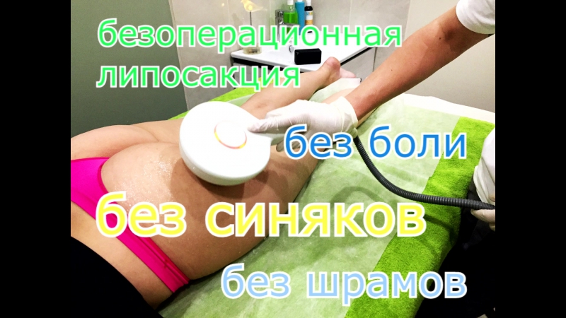 Rf лифтинг безоперационная липосакция со скидкой 40%