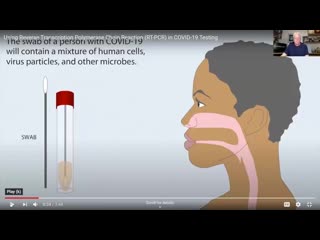 Pcr tests are testing for genetic codes that every human has and not the ‘virus’