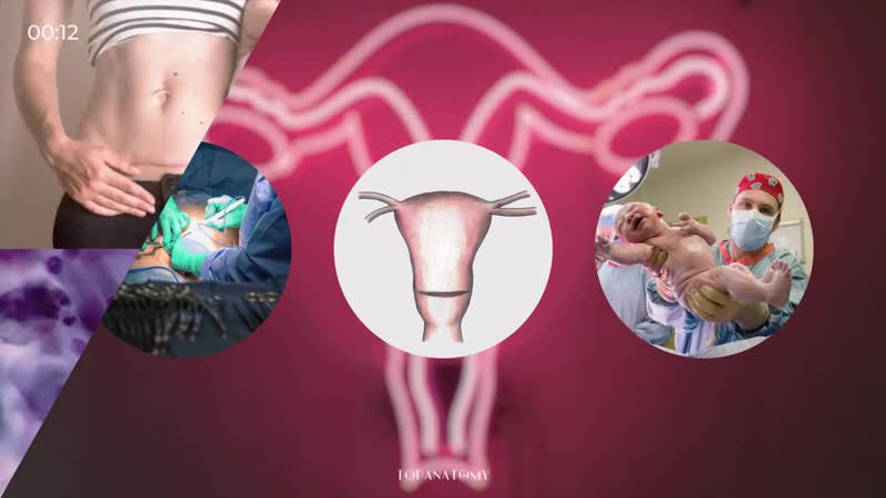 Sll медицина за 30 секунд кесарево сечение