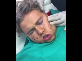 Patty chipmunk in the cut receiving subcision treatment 🐿💉