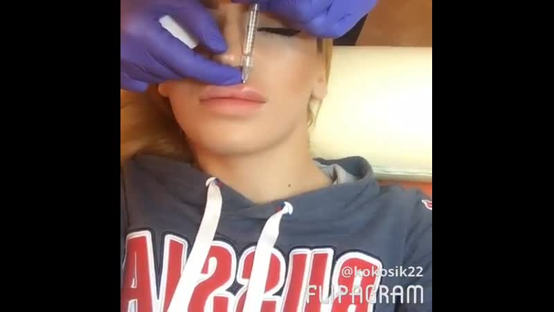 Инъекция в губы