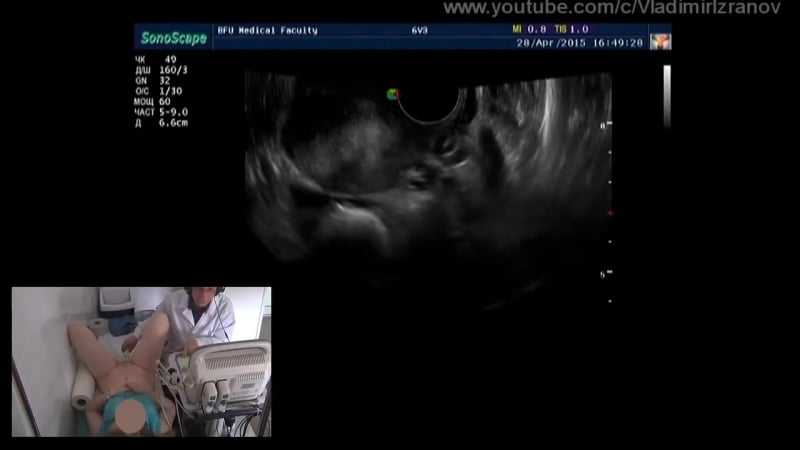 Практическое занятие узи органов малого таза у женщин (пациентка 1)