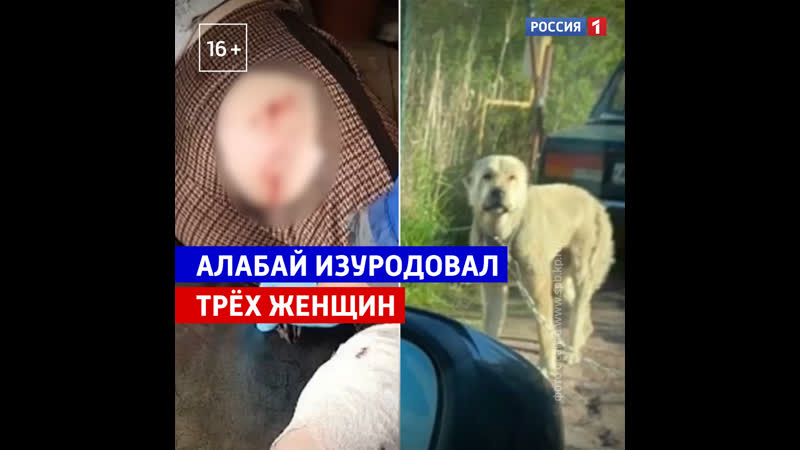 Алабай покусал женщину в ленинградской области россия 1