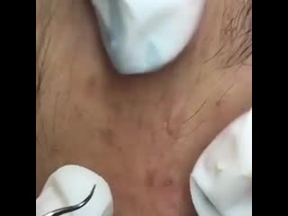 Катастрофически не хватает салфетки