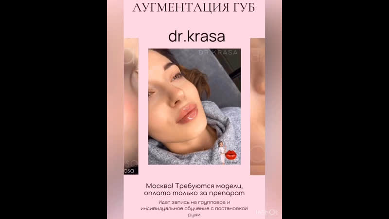 Аугментация губ