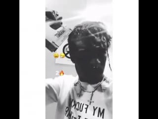 Lil uzi vert puts a staple in his head 😳🤕📎
