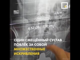 Мун не чувствовал ног, и все остальные врачи отказались помочь ему
