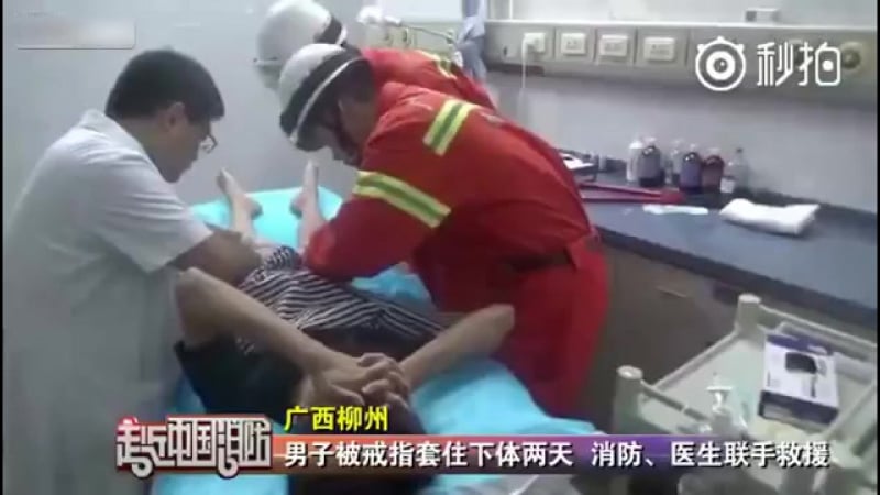 Китаец надел обручальное кольцо на пенис, чтобы сделать предложение, и не смог снять (#tupovideo)