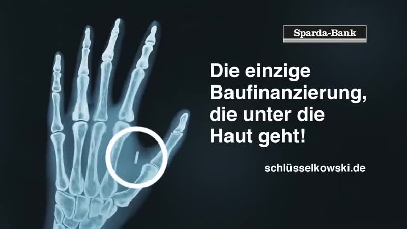 Sparda bank macht werbung für implantierten rfid chip,