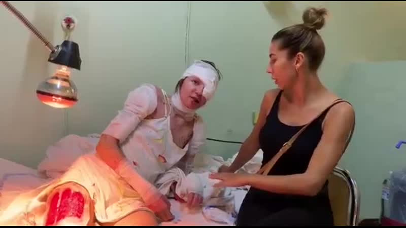 Вилив кипяток в рот з'явилося перше відео з жінкою із запоріжжя