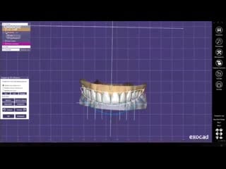 Максим ашортиа моделирование wax up с использованием 2d фото и скана лица в exocad