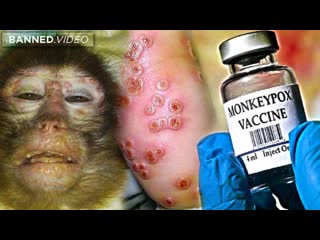 Report how monkeypox was planned for pandemic