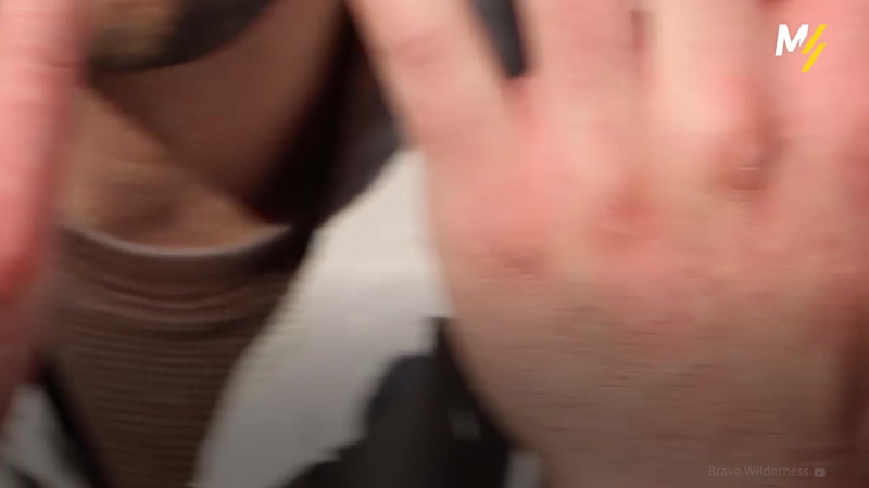 Самые болезненные укусы насекомых