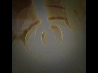 Tower of god | baam | rachel | anime edit