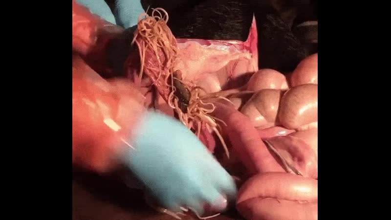 Аскариды в кишечнике