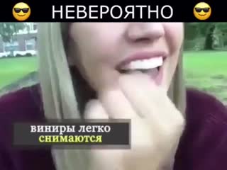 Perfect smile veneers