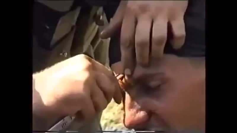 У русского солдата застряла пуля во лбу! не показывайте американцам, им и так тяжело