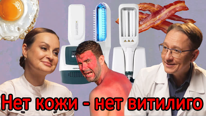 Обзор лампы 311 и лампы вуда облучаться или нет? опасность рядом отзывы