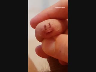 Аха ха у кого есть такой же певец )