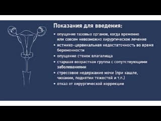 Гинекологический пессарий