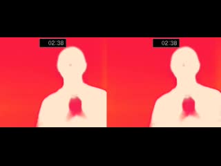 Wonstein infrared camera mv