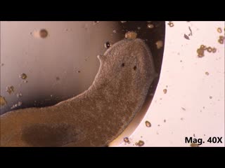 Planaria moving and feeding under the microscope